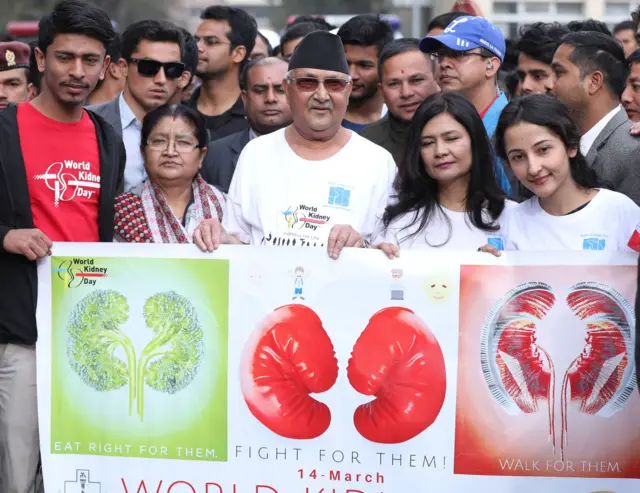 विश्व मिर्गौला दिवस