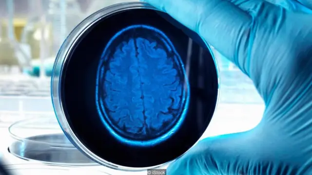 The tiny brains cannot "think" because they do not have a body with which to help process information