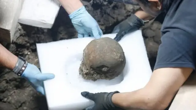 খুলি তুলছেন গবেষকেরা