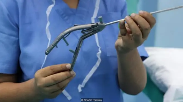 Ngay cả khi được thực hiện trong điều kiện vệ sinh tốt, việc thắt ống dẫn trứng vẫn là nguy hiểm hơn việc thắt ống dẫn tinh - nhưng ở Ấn Độ và các nước khác nó là sự lựa chọn phổ biến nhất.