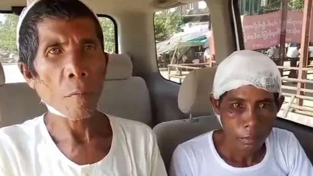 ဦးငမဲ နဲ့ ဦးထွန်းဝေ တို့ ၂ ဦးဟာ ရသေ့တောင် ဆေးရုံမှာ ဆေးဝါးကုသမှု ခံခဲ့ရ