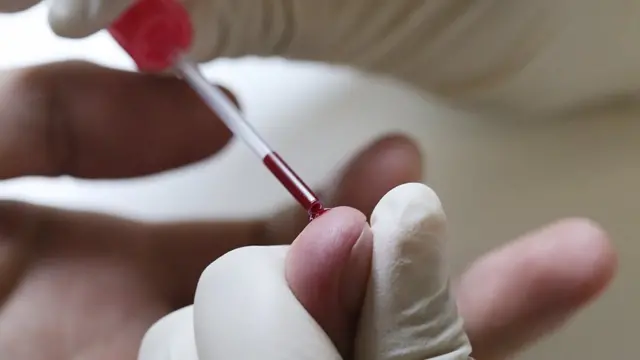 எச்.ஐ.வி: ரத்த தானமும், சந்தேகங்களும்