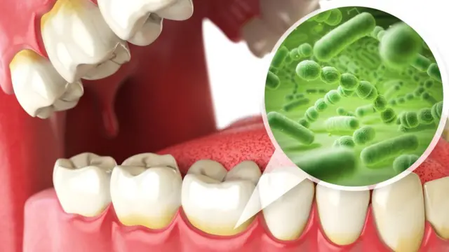 Бактерий во рту действительно очень много, но далеко не все они вредны