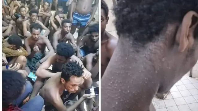 በእስር ላይ የሚገኙ ስደተኞች ለተለያዩ የጤና ችግር መጋለጣቸው እየተነገረ ነው