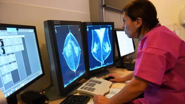 மார்பக புற்றுநோய்