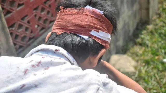 ဆေးရုံရောက်တဲ့ ကလေး ၁၇ ယောက်မှာ ၁၅ ယောက်ကဒဏ်ရာမပြင်းထန်လို့ ပြင်ပလူနာဌာနမှာပဲ ကုသပေးခဲ့တာဖြစ်တယ်လို့ ဆိုပါတယ်။