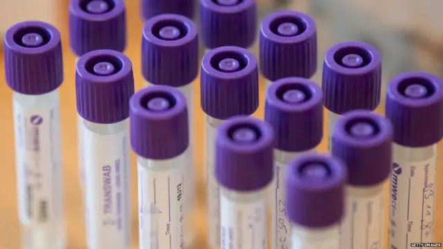 कोरोना वायरस