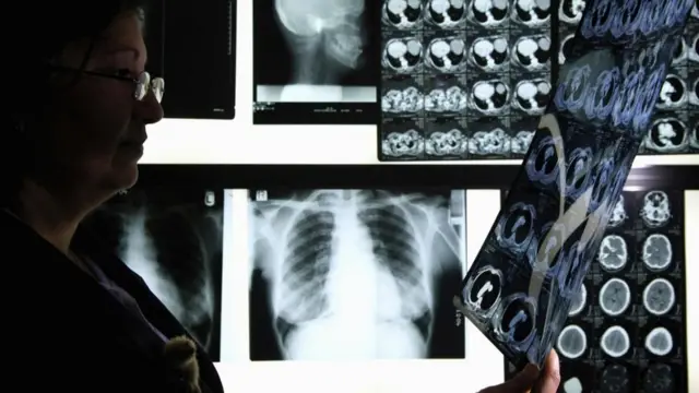L'"intelligence collective" peut aider les radiologues à réduire d'un tiers les erreurs de diagnostic de la pneumonie.