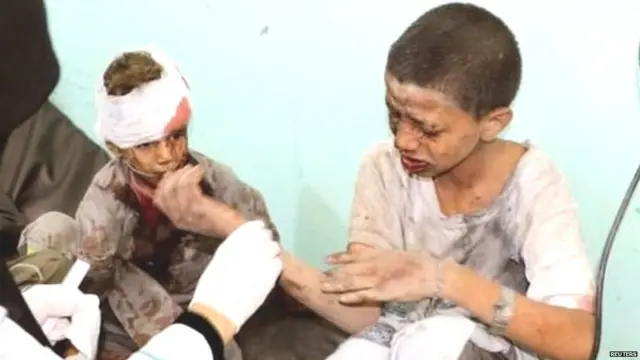 सादा प्रांतात झालेल्या हल्ल्यात जखमी झालेला मुलगा