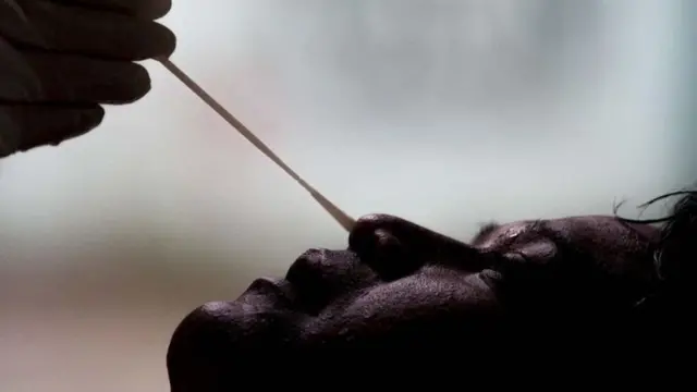 स्वाब सङ्कलन