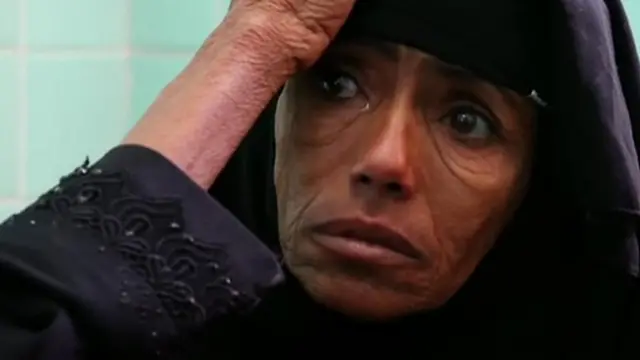 Dhaabbati Biyyoota Gamtoomanii Yaman keessatti namoonni miiliyoona 13 beela'uu ibsa