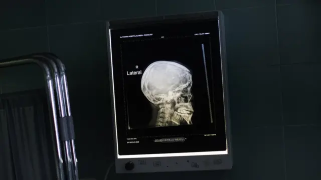 Según los expertos que engloba en Proyecto TENDR, los químicos mencionados aquí afectan al desarrollo neuronal.