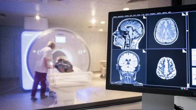 醫院放射科工作人員正在為一名病人進行腦部核磁共振掃描（資料圖片）