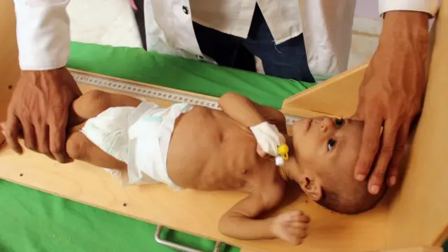 یمن میں ایک متاثرہ بچہ