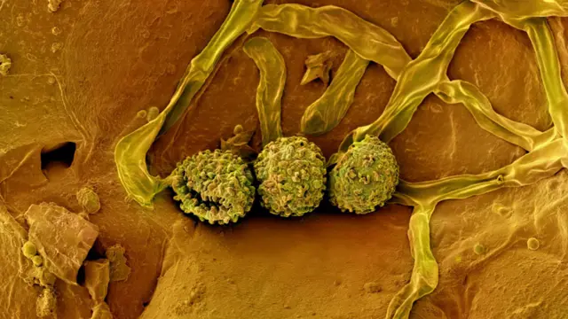 Superficie de una semilla de Coffea humbertii