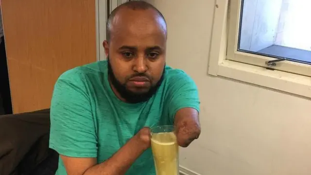 Wiil naafo ah oo noolasha Horumar ka gaaray