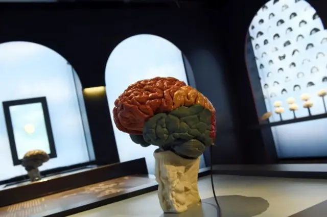 ภาพจำลองสมอง