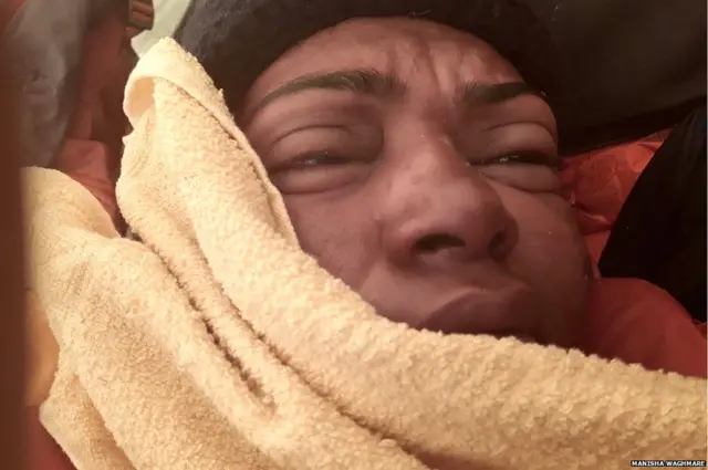 परतीच्या प्रवासात स्नो ब्लाईंडनेस झाल्याचं लक्षात आलं