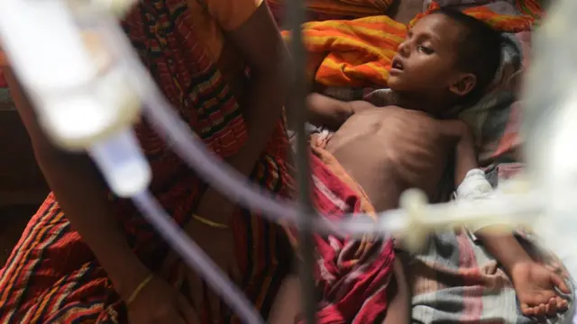 जापानी बुख़ार