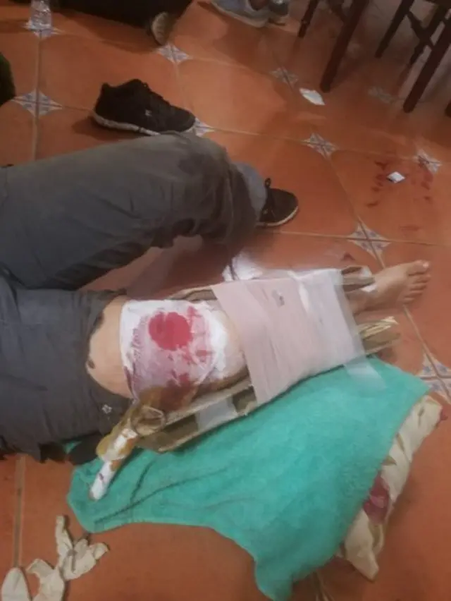 Hombre herido dentro de la iglesia.