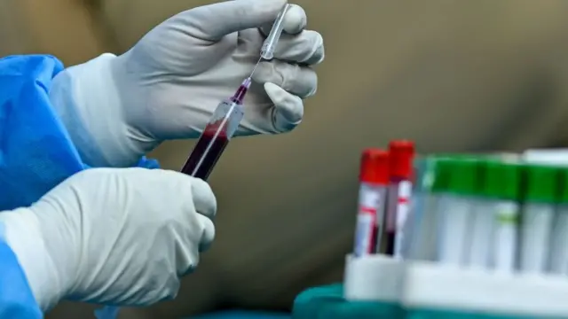 प्लाज़्मा थेरपी