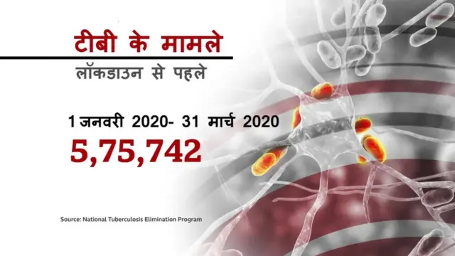 कोरोना से बढ़ा 'साइलेंट किलर' टीबी का ख़तरा