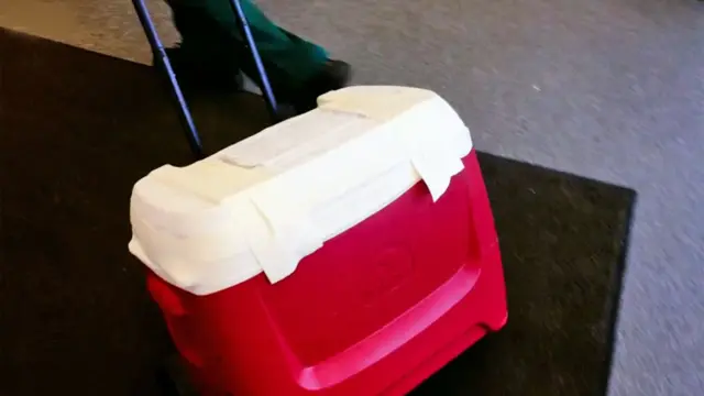 Caja que contiene el hígado