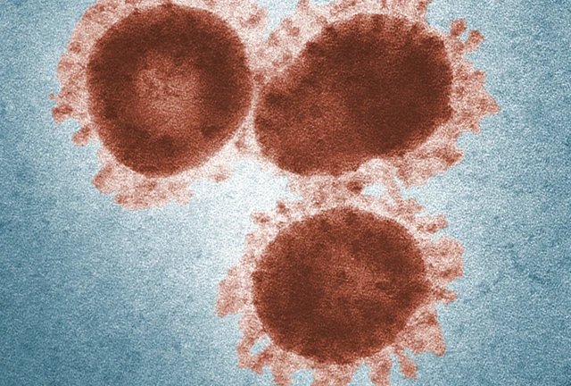 เชื้อไวรัสโรคซาร์ส (SARS-CoV)