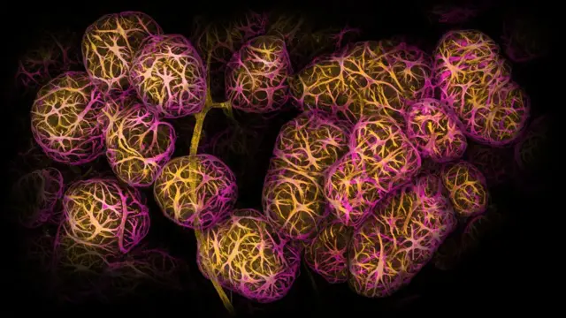 A cluster of contractile myoepithelial cells with their structure highlighted