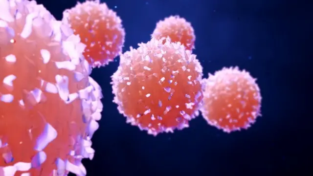 صور خلايا سرطانية