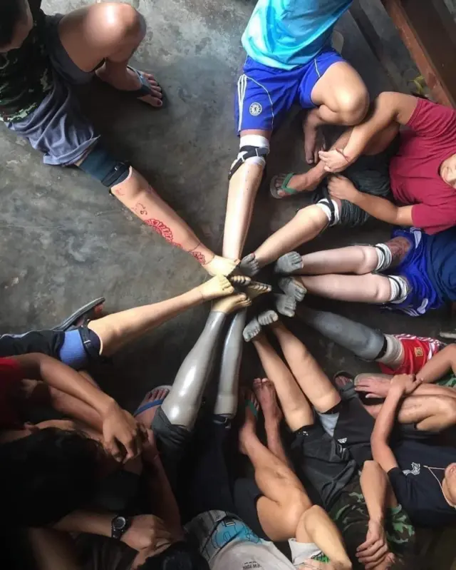 မြေမြှုပ်မိုင်းကြောင့် ခြေထောက်ဆုံးရှုံးခဲ့ရသူတွေကိုတွေ့ရစဉ်။