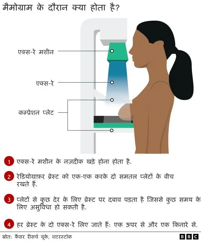 मैमोग्राम क्या होता है?