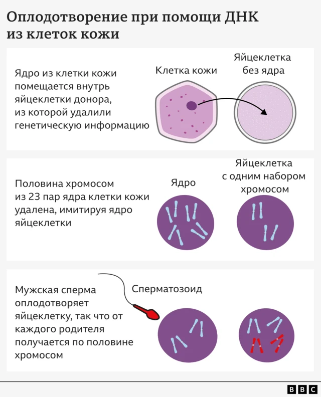 На рисунке показаны различные этапы оплодотворения с использованием клеток кожи. Первый этап — как ядро ​​из клетки кожи помещается в донорскую яйцеклетку, из которой удалена генетическая информация. Ниже показано фиолетовое ядро, у которого удалена половина из 23 пар хромосом, имитирующих обычную яйцеклетку. Ниже показано, как мужской сперматозоид оплодотворяет яйцеклетку и добавляет к ней свои хромосомы, так что половина из них принадлежит каждому из родителей.