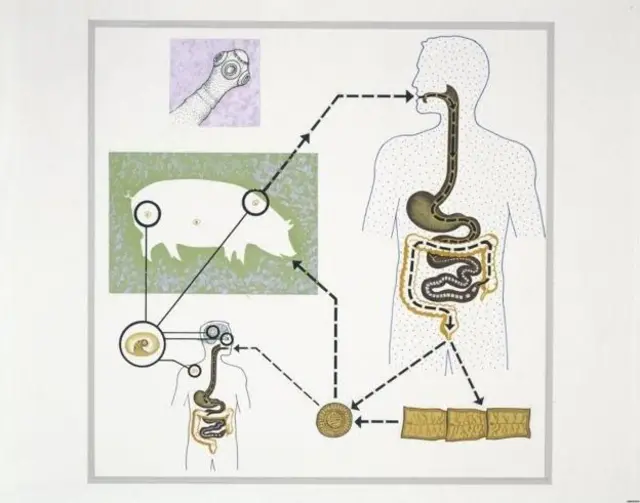 நாடாப்புழு, மூளை, உடல் ஆரோக்கியம்