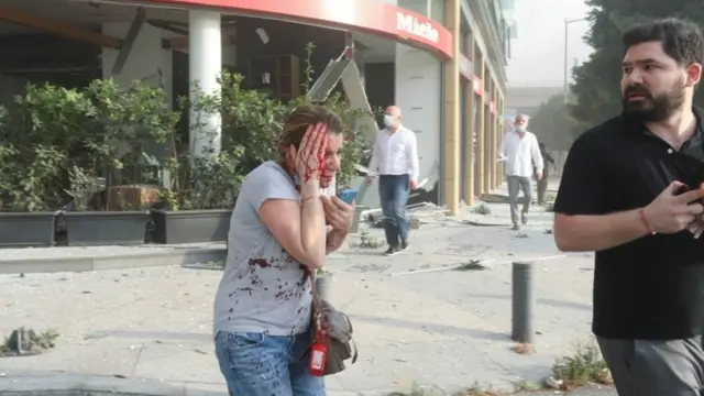 Una mujer herida tras la explosión en Beirut.
