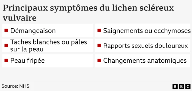
Une illustration qui présente une liste simple des principaux symptômes du lichen scléreux. Les symptômes énumérés sont les suivants : démangeaisons, plaques cutanées blanches ou pâles, peau fripée, saignements ou ecchymoses, rapports sexuels douloureux, modifications anatomiques.