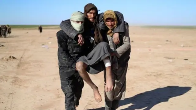 আহত একজন আইএস যোদ্ধাকে নিয়ে আসা হচ্ছে