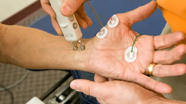 Un examen para medir la conductividad del nervio mediano