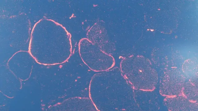 جین تھیراپی