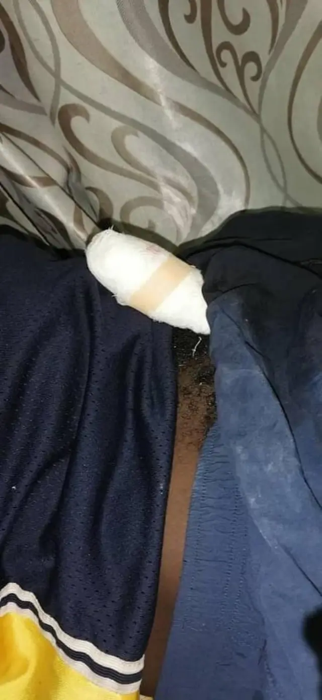 Obìnrin kan ní Ghana gé nkan ọmọkùnrin ẹni tó fi ipá bálòpọ̀ jábọ̀