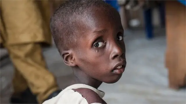 Àwòrán ọmọ tí ebi ń pa