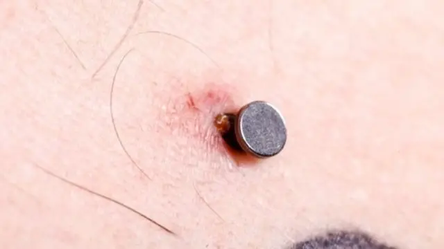 পিয়ার্সিং