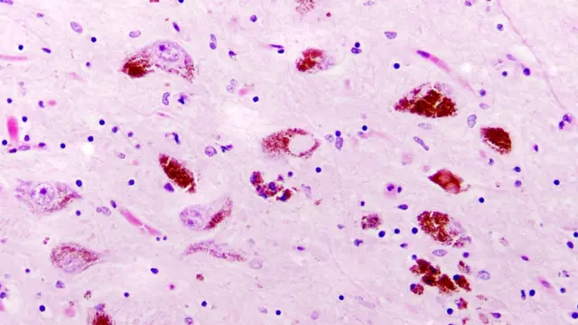 Muestra celular de una neurona.