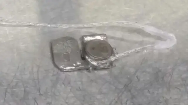 피닉스 99'의 클로즈업 사진. 곧 임상실험이 시작될 것으로 기대되고 있다