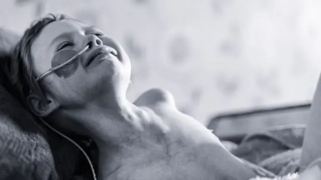 الصورة التي أثارت التعاطف مع جيسيكا