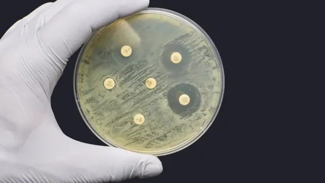 Teste laboratorialnovibet paga mesmoresistência antimicrobiana