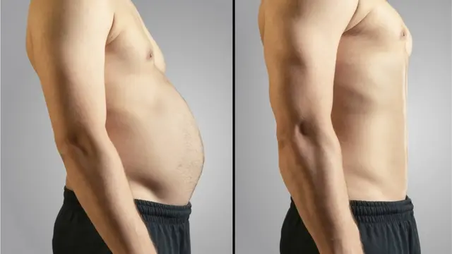 आरोग्य, लठ्ठपणाः तुमच्या आतड्यातले जीवाणू तुमचं वजन ठरवतात?