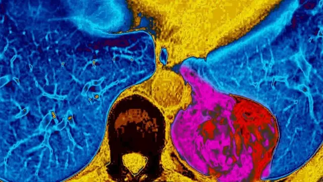 یک مطالعه دریافت که مکمل‌های ویتامین بروز سرطان ریه را در بین سیگاری‌ها افزایش می‌داد، چه برسد به این‌که ما را در برابر بیماری محافظت کنند.