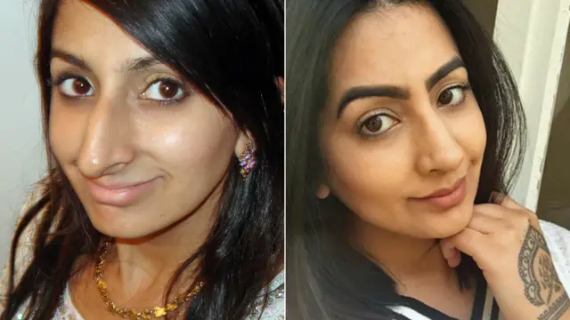 Sharon Dhaliwal, antes e depoissite de aposta para menor de 18 anosplástica no nariz