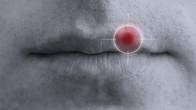 Imagemblaze rboca mostra ponto vermelho onde está representada infecção